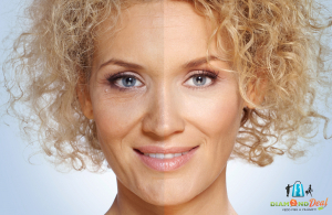 Anti-Aging őssejt kezelés arcizom tornával, 6 lépésben, teljes arcra - viszlát ráncok!