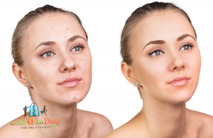 Feszes, gyönyörű bőr YOUNG Beauty arcreform kezelés arctisztítással, masszázzsal, fényterápiával