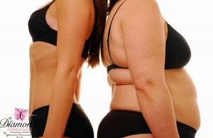 9 kezelés VelaShape-pel, izomstimulációval és vibrotrénerrel. Érj el 6-10 cm körméret csökkenést!