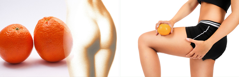 Narancsbőr kezelése Budapest VI. kerületében a Chick Boxban