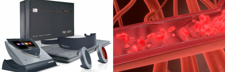 Mellékhatás nélküli Bemer terápia kedvezményesen, a DiamondDeal kuponjával!