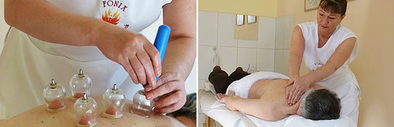 Főnix rendelő, hát, nyak masszázs köpölyözéssel