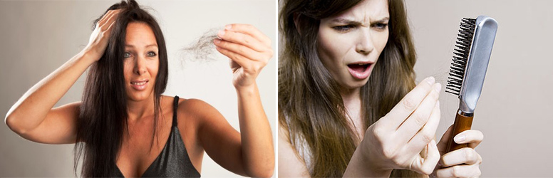 Hajhullás elleni kezelés kedvezményesen, a Diamond Deal kuponjával!