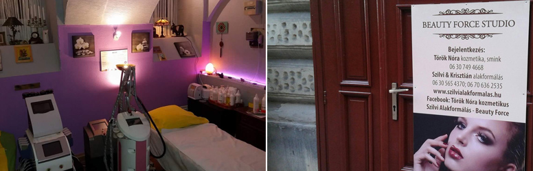 Szabadulj meg a narancsbőrtől és a felesleges kilóktól fogyasztó bérlettel kedvezményesen, a DiamondDeal kuponjával!