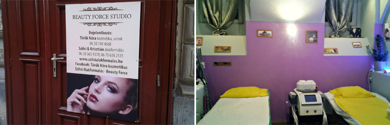 Szabadulj meg a narancsbőrtől és a felesleges kilóktól fogyasztó bérlettel kedvezményesen, a DiamondDeal kuponjával!