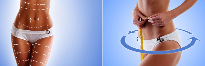 Alakformálás, narancsbőr kezelése lipolézerrel, vibrációs tréninggel, nyirokmasszázzsall