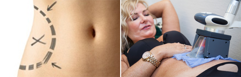 Dobd le a kilókat a DiamondDeal kuponjával a Relax Spa-ban!