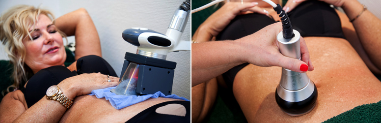 Lipolézer és cryolipolízis kezelés a Relax Spa Központban