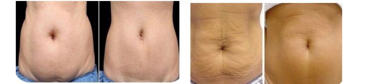 Medklinik súlyprograms