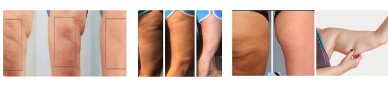 Medklinik súlyprograms