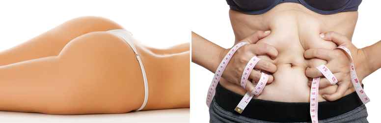 Fogyj a Szépségmegállóban Budapesten a DD kuponjával!