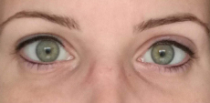 Szemhéj tetoválás - Szempillasűrítés vagy vékonyabb kontúr fekete vagy sötétbarna színnel