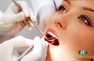 Esztétikus fogtömés vagy töméscsere és állapotfelmérés a White Smile fogászatnál