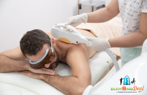 Férfiak, szabaduljatok meg a szőrtől: 1 alkalmas teljes hát és váll SHR szőrtelenítés, 3 helyszínen