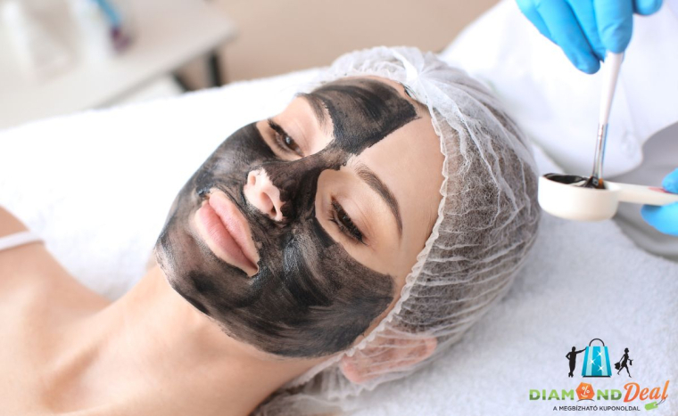 Látványos eredmény gyorsan és könnyedén - Carbon peeling lézeres arckezelés