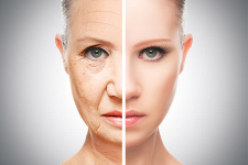 Perfect effect kombi! - Komplex bőrápolási élmény, életteli arcbőr tűszúrás nélkül 4 kezeléssel