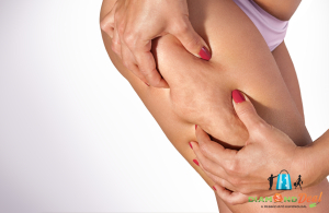 Online Anticellulitkezelő Önmasszázs Tanfolyam a Bessimeon Központ segítségével