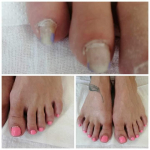 Ragyogóan egészséges lábak - Gyógynövényes Gehwol pedikűr gél lakozással, spa lábápolással