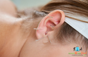 Tarts karban tested és javítsd általános jólléted! -  60 perces fülakupunktúrás kezelés