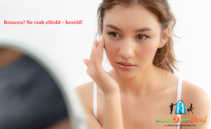 Gyors segítség rosacea ellen – most kedvezményes lézeres kezeléssel, XI. kerületben
