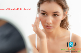 Gyors segítség rosacea ellen – most kedvezményes lézeres kezeléssel, XI. kerületben