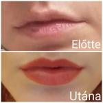 Választható szemöldök vagy száj sminktetoválás az ImageMakeUpTattoo-ban