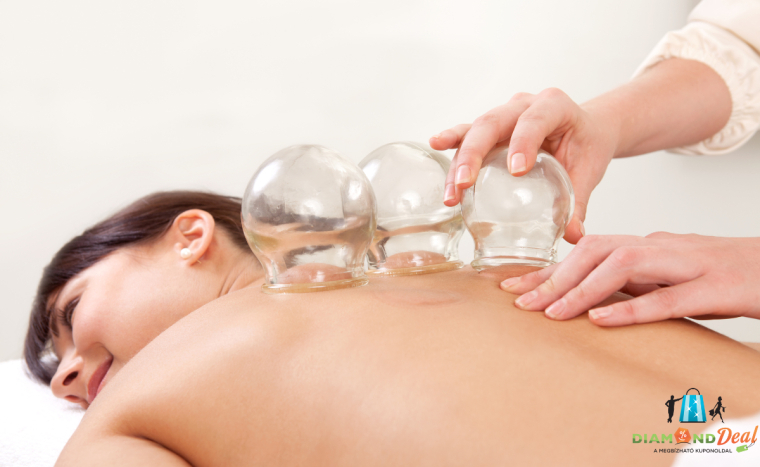 60 perces méregtelenítő teljes testmasszázs köpölyözéssel, XIII. kerületben