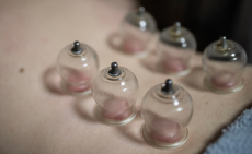 60 perces méregtelenítő teljes testmasszázs köpölyözéssel, XIII. kerületben