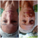 Zöld almás őssejtes mini arcmasszázs – gyors felfrissülés 20 perc alatt, Zuglóban