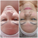 Zöld almás őssejtes mini arcmasszázs – gyors felfrissülés 20 perc alatt, Zuglóban