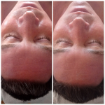 Zöld almás őssejtes mini arcmasszázs – gyors felfrissülés 20 perc alatt, Zuglóban