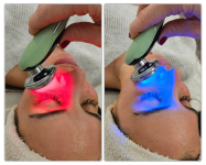 Fiatalodj látványosan már 1 alkalom után! Elektro-lifting kezelés arcmasszázzsal a XIII. kerületben