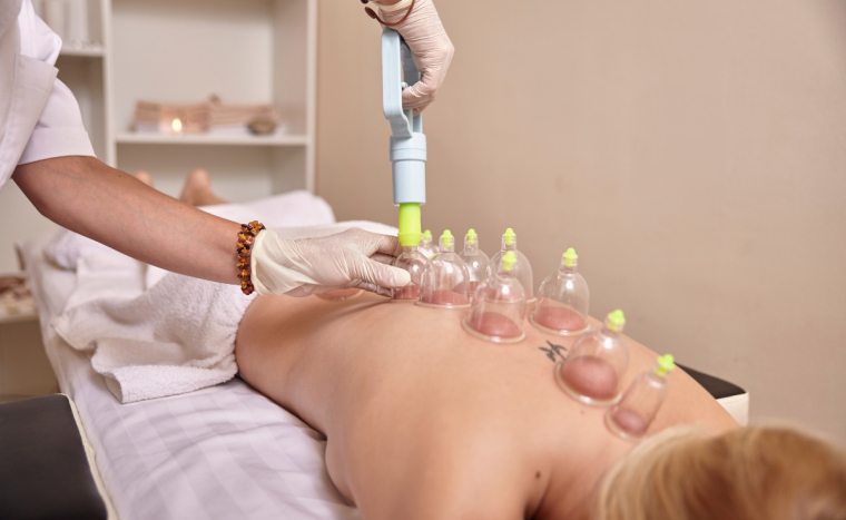 60 perces hátmasszázs köpölyözéssel – természetes módszer a fájdalom enyhítésére, XIII. kerületben