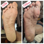 Egészséges lábak biztonságosan - Szikementes pedikűr akár cukorbetegek részére is, VIII. kerületben