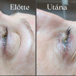 Természetesen szép pillantások, szempilla Liftinggel a VII.kerületben