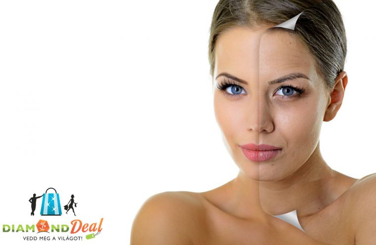 CSÚCShatás! Hialurox softlézeres arcfeltöltés 1 vagy 3 alkalomra a Relax Spa Központban!