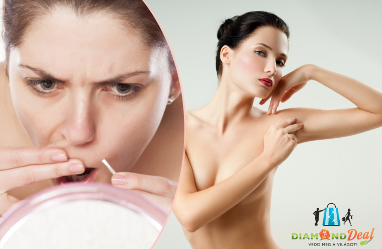 Alkar vagy felkar, teljes arc sima gyantával, hónalj, bajusz cukorgyantával, bejelentkezés nélkül