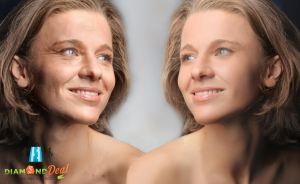 Vesd be a bőrfeszesítés csodafegyverét! 9 részes Thermage kezelés arcra, nyakra, tokára, dekoltázsra