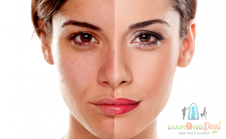 Mikrodermabráziós arckezeléssel, bio kozmetikumos pakolással a ráncok, hegek és foltok ellen