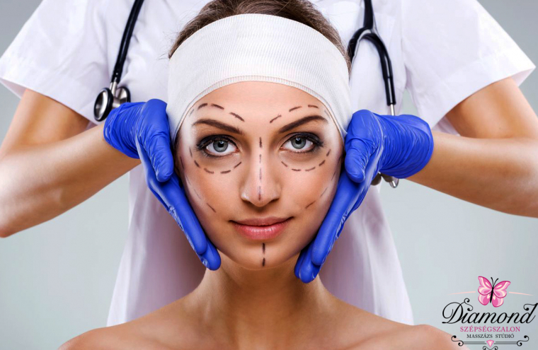 Ultralift HIFU ránctalanító kezelés a teljes arcon, állvonalig +ajándék hidratáló arcpakolás