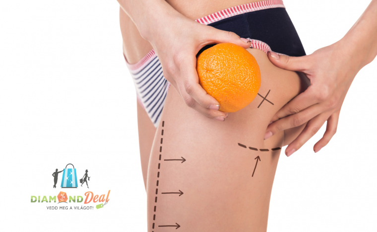 5 alkalmas testtekercselés bérlet, minden alkalommal táplálkozási tanácsadással