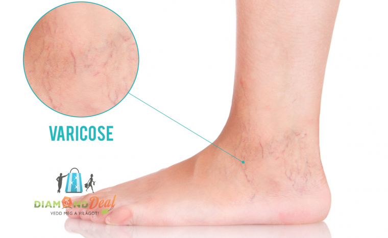 E-LIGHT seprűvéna kezeléscsomag választható területen