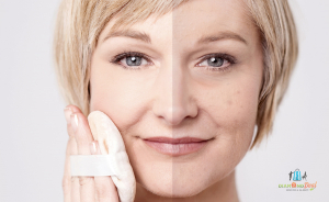 Extrém hatású mezotica peptides, bőrfeltöltő, bőrfeszesítő, hidratáló arckezelés Budaörsön! 