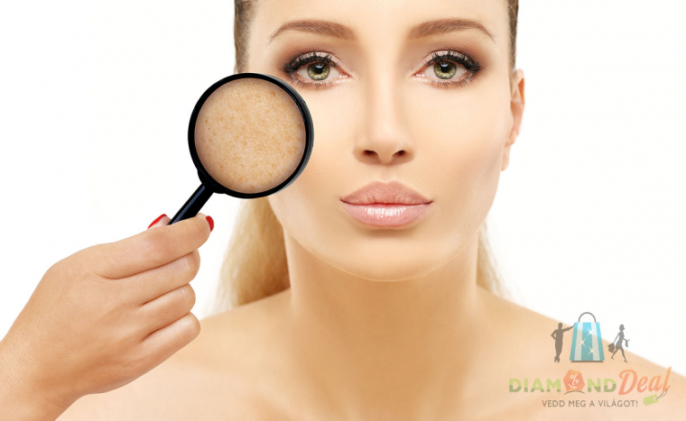 10 alkalmas hegkezelő, pigment- és májfolt eltávolító kezeléssorozat, a Móricz Zsigmond körtérnél