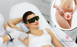 5 alkalom BioMed SHR végleges szőrtelenítés hónaljra + bikinivonalra!