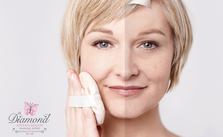 40 felett fiatalosan: szépségcsomag HIFU és rádiófrekvenciás arc és toka fiatalítással az Oktogonnál