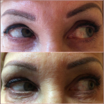 Szempilla lifting hetekig tartó hosszú és dús hatással, ajándék tartós pillafestéssel Csepelen