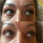 Szempilla lifting hetekig tartó hosszú és dús hatással, ajándék tartós pillafestéssel Csepelen