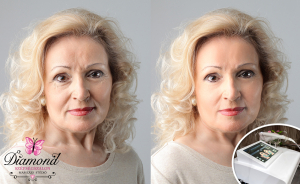 Fiatalítás! 1 alkalom szarkaláb vagy homlok vagy toka UltraLiftHIFU kezelés + arcpakolás, Oktogonnál