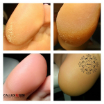 Callux 4 lépéses professzionális pedikűr, gyümölcssavas hámlasztással!